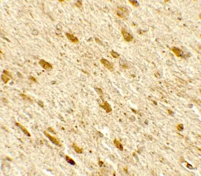 Anti-DENR antibody used in IHC (Paraffin sections) (IHC-P). GTX31918