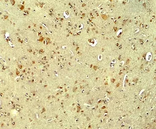 Anti-Parkin antibody used in IHC (Paraffin sections) (IHC-P). GTX31927
