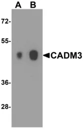 Anti-CADM3 antibody used in Western Blot (WB). GTX31935