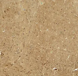 Anti-RHOT1 antibody used in IHC (Paraffin sections) (IHC-P). GTX31938