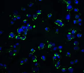 Anti-KIR2DS2 antibody used in Immunocytochemistry/ Immunofluorescence (ICC/IF). GTX31949