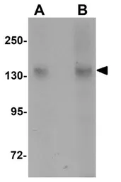 Anti-NLRC3 antibody used in Western Blot (WB). GTX31989