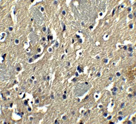 Anti-PION antibody used in IHC (Paraffin sections) (IHC-P). GTX32001