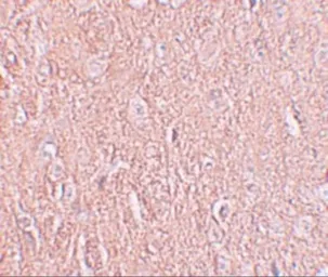 Anti-LRRTM2 antibody used in IHC (Paraffin sections) (IHC-P). GTX32002
