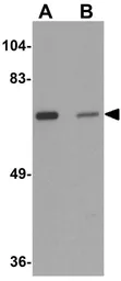 Anti-LRRTM2 antibody used in Western Blot (WB). GTX32002