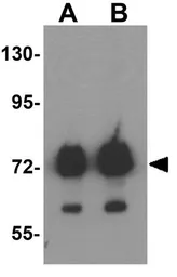 Anti-ATAD3B antibody used in Western Blot (WB). GTX32018