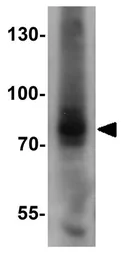 Anti-AFAP1L1 antibody used in Western Blot (WB). GTX32040