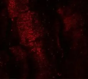 Anti-MEX3B antibody used in IHC (Paraffin sections) (IHC-P). GTX32049
