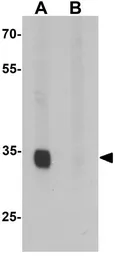 Anti-SLAIN1 antibody used in Western Blot (WB). GTX32052