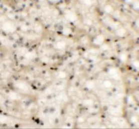 Anti-Nkx2.6 antibody used in IHC (Paraffin sections) (IHC-P). GTX32059