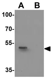 Anti-KIAA0141 antibody used in Western Blot (WB). GTX32077