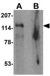 Anti-SGSM2 antibody used in Western Blot (WB). GTX32094