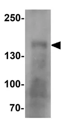 Anti-CRB1 antibody used in Western Blot (WB). GTX32103