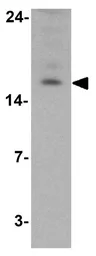 Anti-LAMTOR2 antibody used in Western Blot (WB). GTX32131