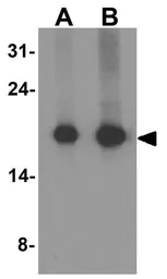 Anti-HOPX antibody used in Western Blot (WB). GTX32152