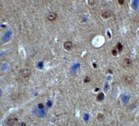 Anti-PACS1 antibody used in IHC (Paraffin sections) (IHC-P). GTX32158