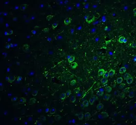 Anti-PACS1 antibody used in IHC (Paraffin sections) (IHC-P). GTX32158