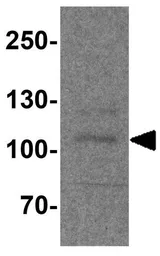 Anti-PACS1 antibody used in Western Blot (WB). GTX32158