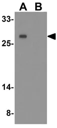 Anti-PMEPA1 antibody used in Western Blot (WB). GTX32162