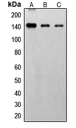 Anti-FGFR1 (phospho Tyr766) antibody used in Western Blot (WB). GTX32182