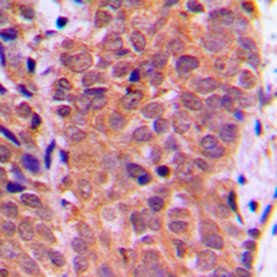 Anti-FOXO1 (phospho Ser319) antibody used in IHC (Paraffin sections) (IHC-P). GTX32183