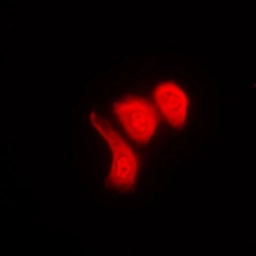 Anti-hnRNP K (phospho Ser284) antibody used in Immunocytochemistry/ Immunofluorescence (ICC/IF). GTX32194