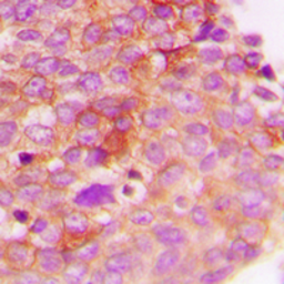Anti-IRS1 (phospho Ser307) antibody used in IHC (Paraffin sections) (IHC-P). GTX32202