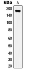 Anti-IRS1 (phospho Ser307) antibody used in Western Blot (WB). GTX32202