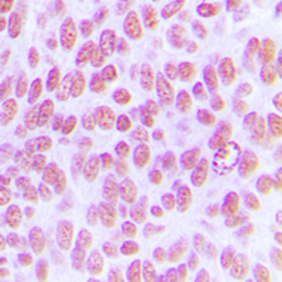 Anti-c-Jun (phospho Tyr170) antibody used in IHC (Paraffin sections) (IHC-P). GTX32205