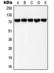 Anti-LIMK1 (phospho Thr508) + LIMK2 (phospho Thr505) antibody used in Western Blot (WB). GTX32211