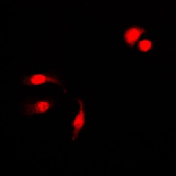Anti-NFkB p105 (phospho Ser927) antibody used in Immunocytochemistry/ Immunofluorescence (ICC/IF). GTX32222