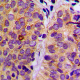 Anti-PLCG2 (phospho Tyr753) antibody used in IHC (Paraffin sections) (IHC-P). GTX32240