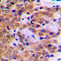 Anti-STAT5A (phospho Ser780) antibody used in IHC (Paraffin sections) (IHC-P). GTX32268