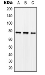 Anti-Synapsin I (phospho Ser62) antibody used in Western Blot (WB). GTX32272