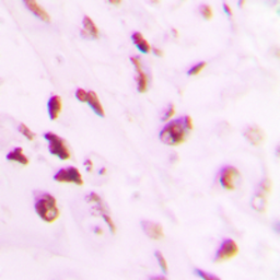 Anti-p73 (phospho Tyr99) antibody used in IHC (Paraffin sections) (IHC-P). GTX32277