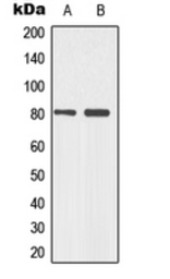 Anti-p73 (phospho Tyr99) antibody used in Western Blot (WB). GTX32277