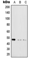 Anti-IKK gamma (phospho Ser31) antibody used in Western Blot (WB). GTX32282
