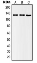 Anti-HDAC5 (phospho Ser498) antibody used in Western Blot (WB). GTX32287