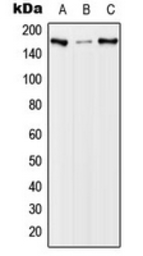 Anti-EGFR (phospho Thr654) antibody used in Western Blot (WB). GTX32321