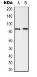 Anti-Cortactin (phospho Tyr421) antibody used in Western Blot (WB). GTX32325