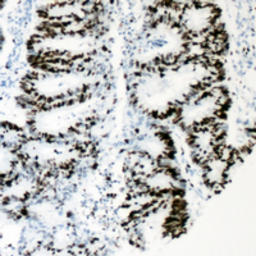 Anti-HNF4 alpha (phospho Ser313) antibody used in IHC (Paraffin sections) (IHC-P). GTX32329