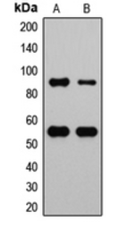 Anti-MDM2 (phospho Ser166) antibody used in Western Blot (WB). GTX32336