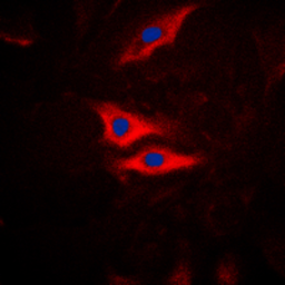 Anti-PLA2G4A (phospho Ser505) antibody used in Immunocytochemistry/ Immunofluorescence (ICC/IF). GTX32342