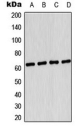 Anti-AMPK alpha 1 (phospho Ser496) antibody used in Western Blot (WB). GTX32345