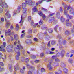 Anti-p70 S6K (phospho Thr444) antibody used in IHC (Paraffin sections) (IHC-P). GTX32353