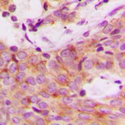 Anti-p70 S6K (phospho Ser447) antibody used in IHC (Paraffin sections) (IHC-P). GTX32354