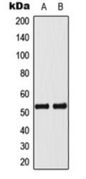 Anti-p53 (phospho Ser33) antibody used in Western Blot (WB). GTX32360