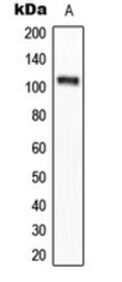 Anti-eEF2K (phospho Ser366) antibody used in Western Blot (WB). GTX32365
