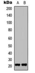 Anti-p21 Cip1 (phospho Thr145) antibody used in Western Blot (WB). GTX32376