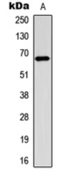 Anti-Estrogen Receptor alpha (phospho Ser106) antibody used in Western Blot (WB). GTX32390